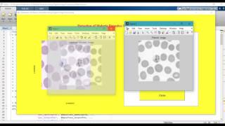 Detection of Malaria Parasites Using Digital Image Processing matlab projects