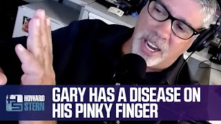 Gary Has a Disease on His Pinky Finger
