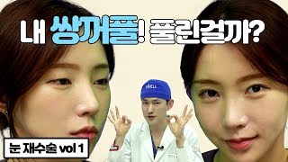 환자분 이건 풀린 거예요~ 쌍꺼풀 풀림 여부 자가진단법 | iWELL Plastic Surgery 아이웰성형외과