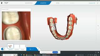 Primescan Scanning Techniques