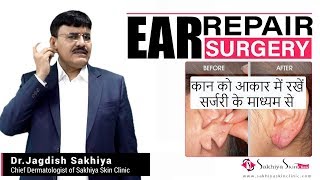 Ear Repair | Torn Ear Lobe repair | कान को आकार में रखें  सर्जरी के माध्यम से | Dr. Jagdish Sakhiya