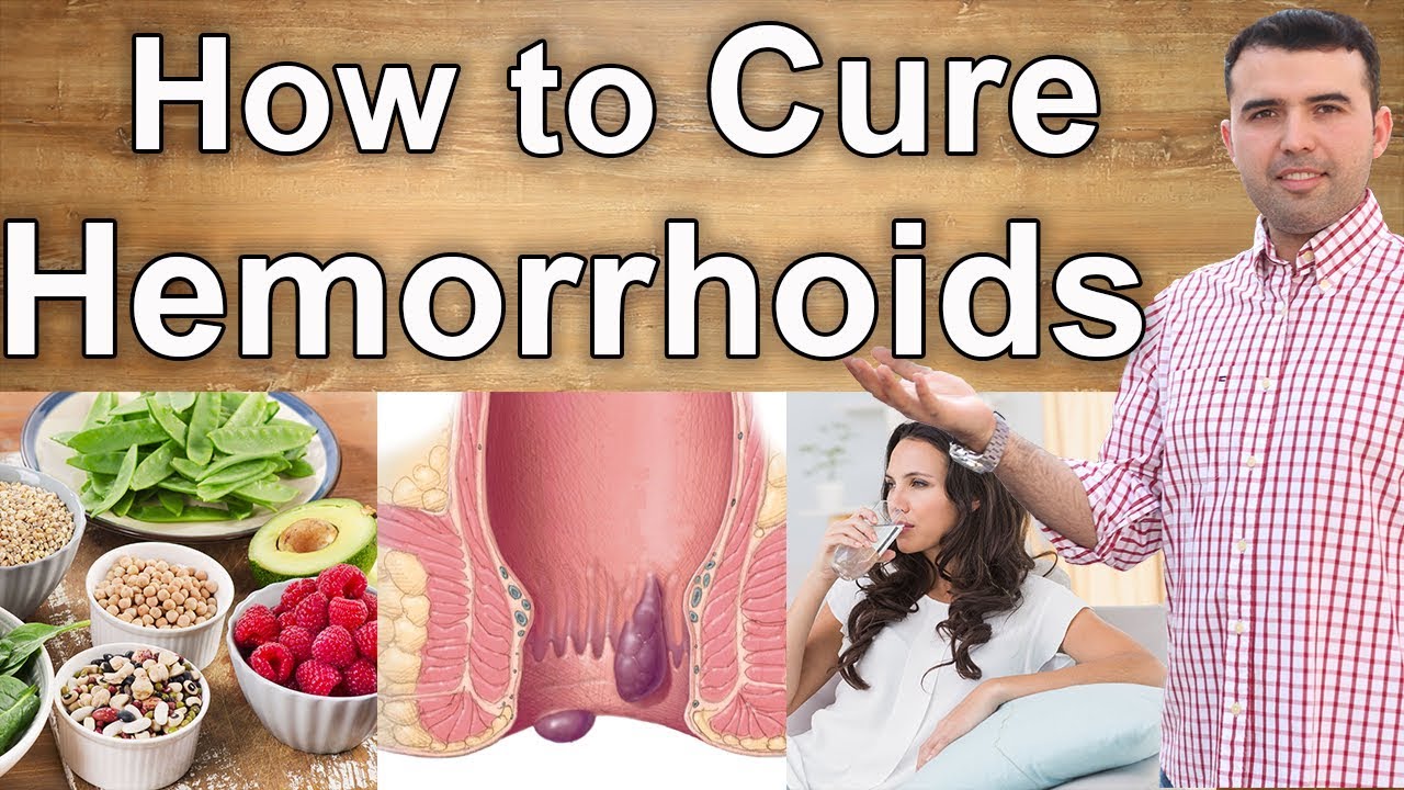 External Hemorrhoids Treatment At Home