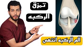 افضل الطرق الفعالة 100% لعلاج تمزق أربطة الركبة وقطع غضروف الركبه: كيفية تخفيف الم الركبه بعد السقوط