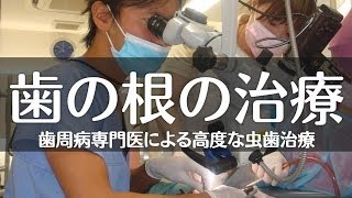 川口市・蕨市・草加市で虫歯（むし歯）治療なら吉野歯科医院「京浜東北線川口駅徒歩3分」~顕微鏡を使った根管（歯の根）治療~