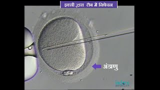 IVF procedure / Test tube baby formation live video | Invitro Fertilization | IVF