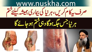 Hernia Ka Gharelu ilaaj | Hernia Exercises Without Surgery Dr Sharafat Ali Health Tips New Video