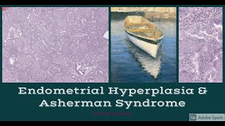 Endometrial hyperplasia and Asherman Syndrome