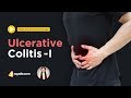 Ulcerative Colitis -I | Gastroenterology Lectures | Medicine Education | V-Learning™