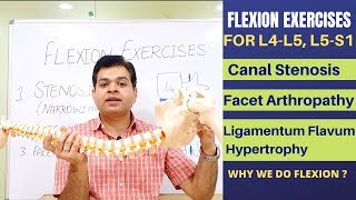 Flexion Exercises For Lumbar Canal Stenosis, Facet Joint Arthropathy, Ligamentum Flavum Hypertrophy