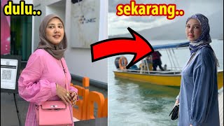 Netizen Terkejut Tengok Wajah Terbaru Fathia Latif