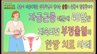 자궁근종으로 인해 40일이 넘게 계속되던 부정출혈을 멈추게 했던 한방 치료 사례 소개