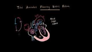 Total Anomalous Pulmonary Venous Return