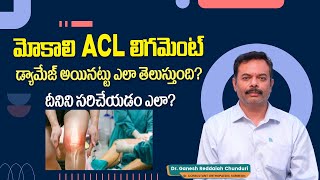 ACLడామేజ్ | How to Fix ACL Tear? | Symptoms and Treatment of ACL Tear Telugu | Raghavendra Hospitals