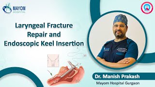 Laryngeal Fracture Repair and Endoscopic Keel Insertion- Dr Manish Prakash Mayom Hospital Gurugram