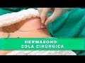 Dermabond para cirurgia de prótese de mama