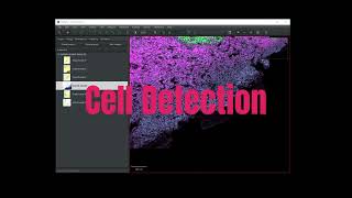 QuPath: Cell Detection