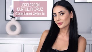 Lekelerle Nasıl Başa Çıkabiliriz? 👌Güncel Öneriler │Sivilce İzleri İçin Öneriler