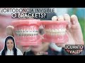 ¿Ortodoncia invisible o Brackets? ¿Cuál es su precio? - Odontología Láser.