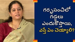 Uterine Fibroids Symptoms Causes and Treatment | గర్భసంచిలో గడ్డలు ఎందుకొస్తాయి, వస్తే ఏం చెయ్యాలి?