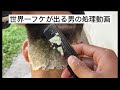 世界一フケ が出る男のディープクリーニング動画　dandruff video treatment