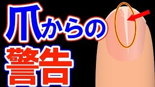 【驚愕】爪を見たら分かる！？5つの症状と健康状態…早速確認！