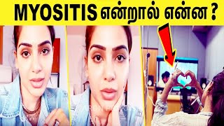 சமந்தாவை பாதித்த Myositis நோய் என்றால் என்ன?