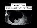 8 weeks and 3 days pregnancy ultrasound!