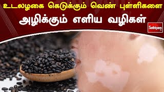 உடலழகை கெடுக்கும் வெண் புள்ளிகளை அழிக்கும் எளிய வழிகள் | Web Special | Sathiyam Tv