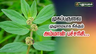 முகப்பருவை முழுமையாக நீக்கும் அம்மான் பச்சரிசி...! Dr.Jayaroopa | #Puthuyugamtv 14/12/2023