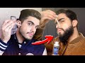 Como usar MINOXIDIL para crescer BARBA 🧔🏻‍♂️