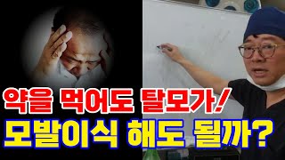 [라이브 시청자 질문] 26년째 약을 먹고 있습니다. 머리가 그래도 빠지는데 모발이식 해도 될까요?