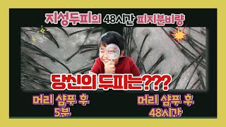 지성두피? 건성두피? \