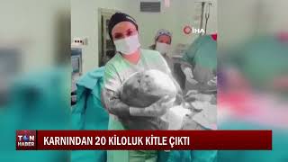 KARNINDAN 20 KİLOLUK KİTLE ÇIKTI