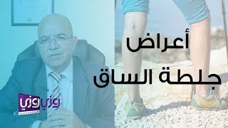 أعراض جلطة الساق وأسبابها