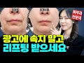 피부과의사가 받는 리프팅을 쫙 정리해봤습니다 | 울쎄라 써마지 올리지오 텐써마 슈링크 튠페이스 티타늄 리프팅 리프팅효과 후기