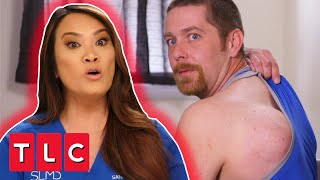 Bowling Ball Lipoma Removed From Mans Back! | Dr Pimple Popper: This Is Zit