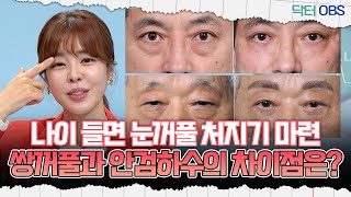 [닥터OBS] 나이 들면 눈꺼풀 처지기 마련, 쌍꺼풀과 안검하수의 차이점은?