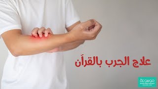 كيفية علاج الجرب بالقران والرقية الشرعية والطب البديل مجرب وسريع