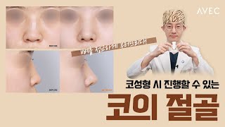 초음파 피에조 절골 ㅣ\