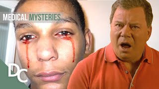 Amazing Medical Mysteries Of The World | Weird or What? | Ft. William Shatner | Documentary Central