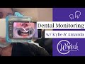 How Does Dental Monitoring Work?