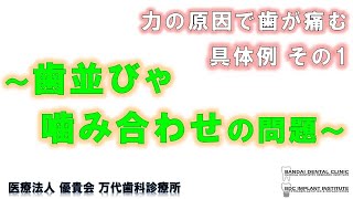 群馬 前橋 高崎 歯科 かみ合わせ 万代歯科 『 力の原因で歯が痛む 具体例 その１ ～歯並びや噛み合わせの問題～  』