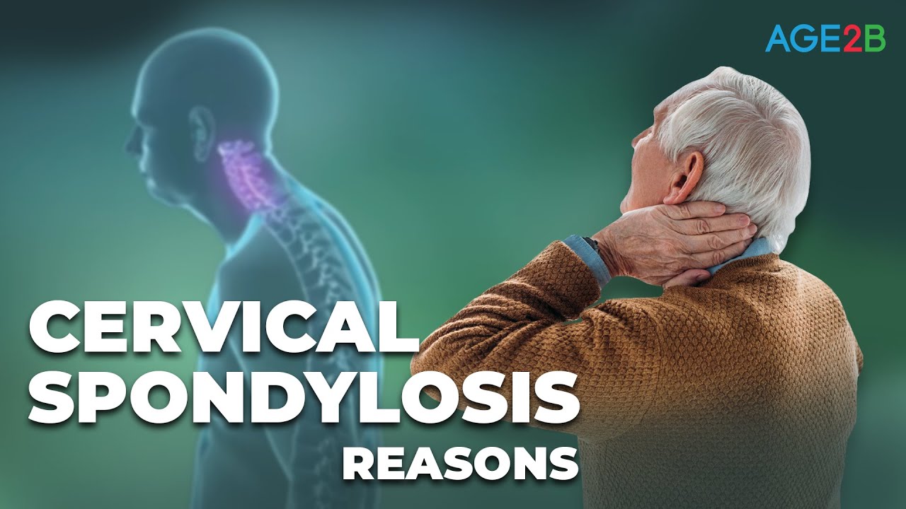 CERVICAL SPONDYLOSIS Causes, Symptoms And Treatment | How To Stop ...