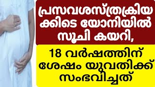 പ്രസവശസ്ത്രക്രിയക്കിടെ യോനിയിൽ ‌സൂചി കയറി,ഞെട്ടിക്കുന്ന സംഭവം 😲😲#viralnews #pention_news #pention