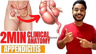 appendicitis anatomy appendix clinical anatomy | clinical anatomy of appendix mcburneys point