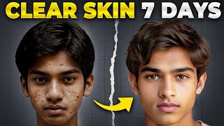 7 రోజుల్లో Clear Skin | 10x Glow ✨ Tips for Naturally Glowing Skin and Home Remedies