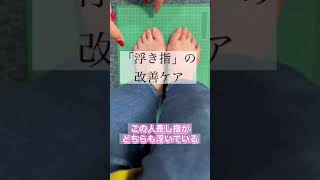 浮き指の改善ケア