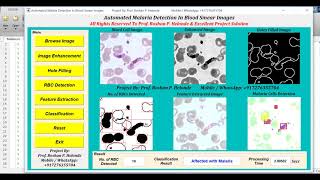 Matlab Code For Malaria Detection In Blood Smear Images Using Image Processing || IEEE Based Project