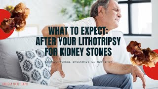 What to expect after your Lithotripsy procedure for Kidney Stones (2020) | ESWL / Shockwave Therapy