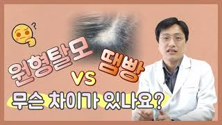 원형탈모 🆚 땜빵 무슨차이가 있나요? 회복이 가능한 것은 OO뿐?